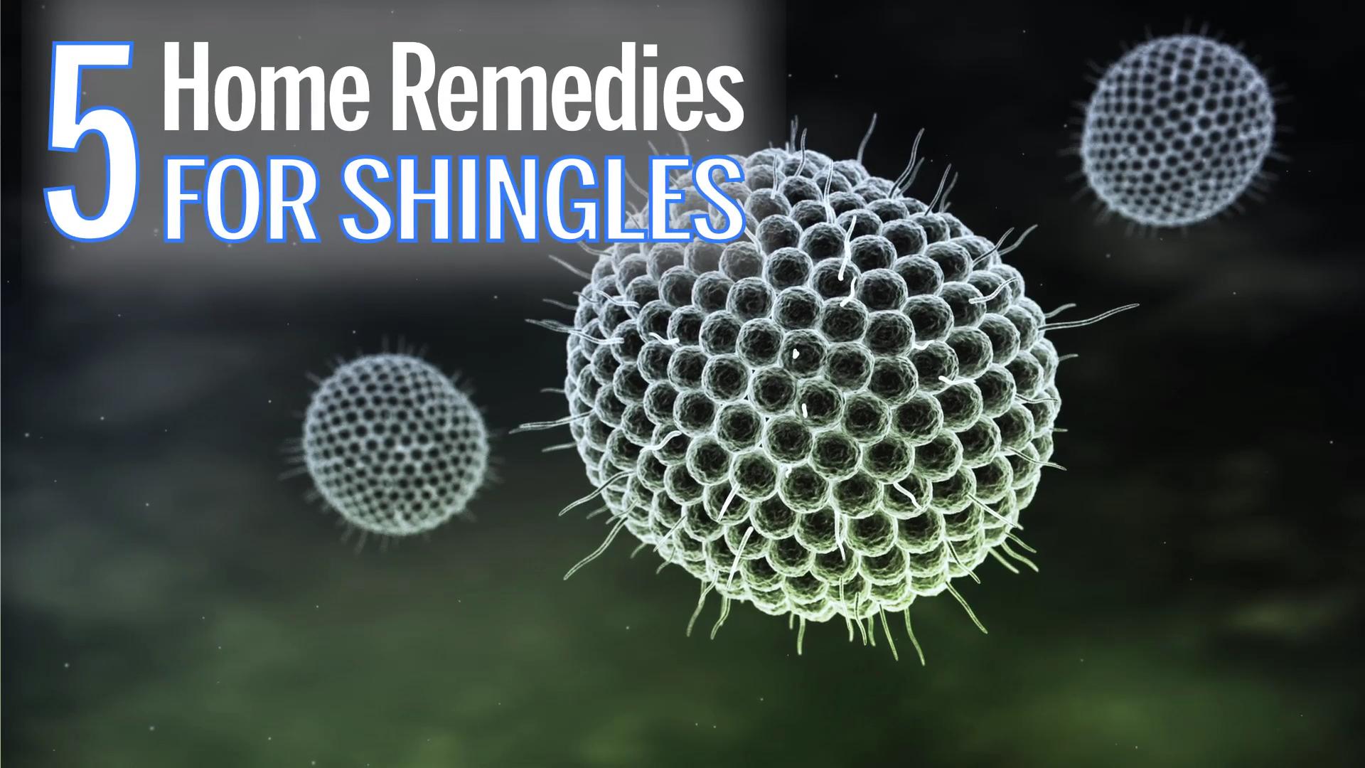 Home Remedies and Natural Treatment Of Shingles – Truebodyhack.com