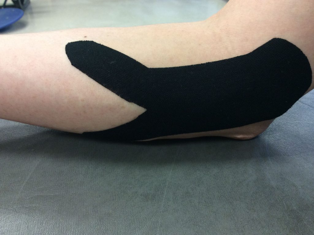 Using Kinesiology Tape To Reduce Injury And Improve Recovery ...